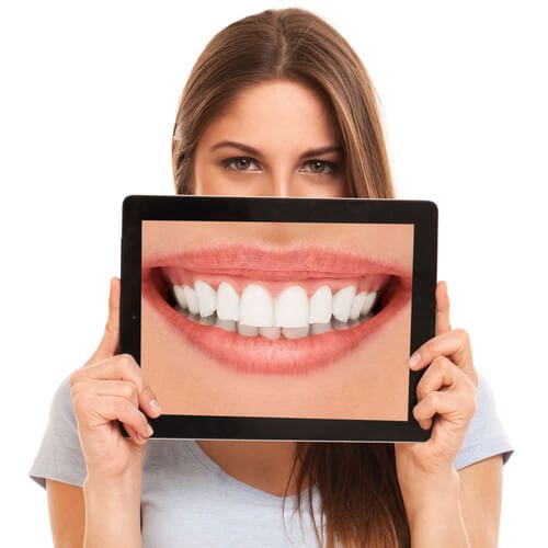 Cosmetic Dentistry-Veneers-Dental Bonding