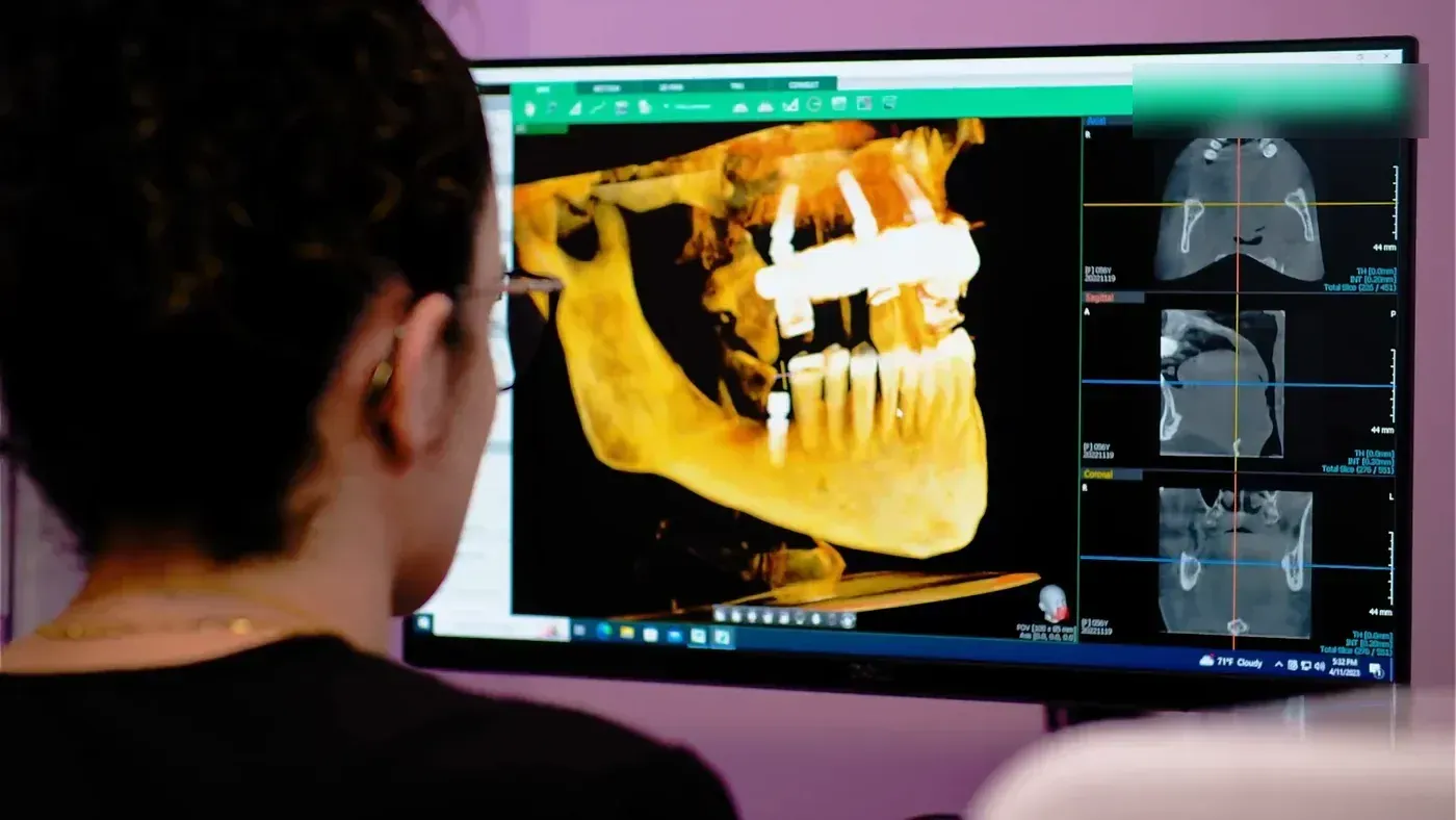 Team member reviewing a 3D CT scan of a jaw with dental implants before implant bridge surgery
