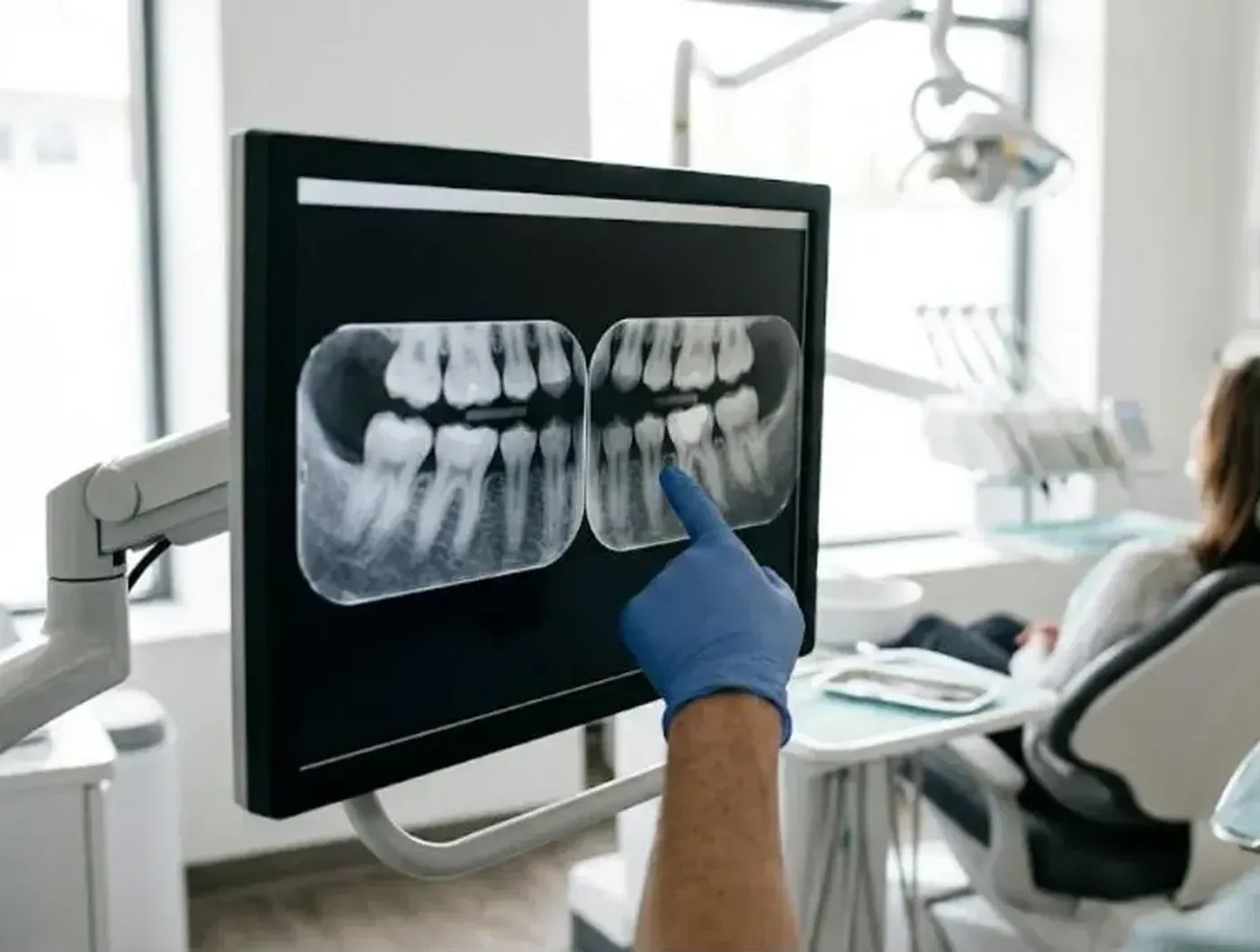 Gloved hand pointing to a tooth on digital x-rays during a dental exam