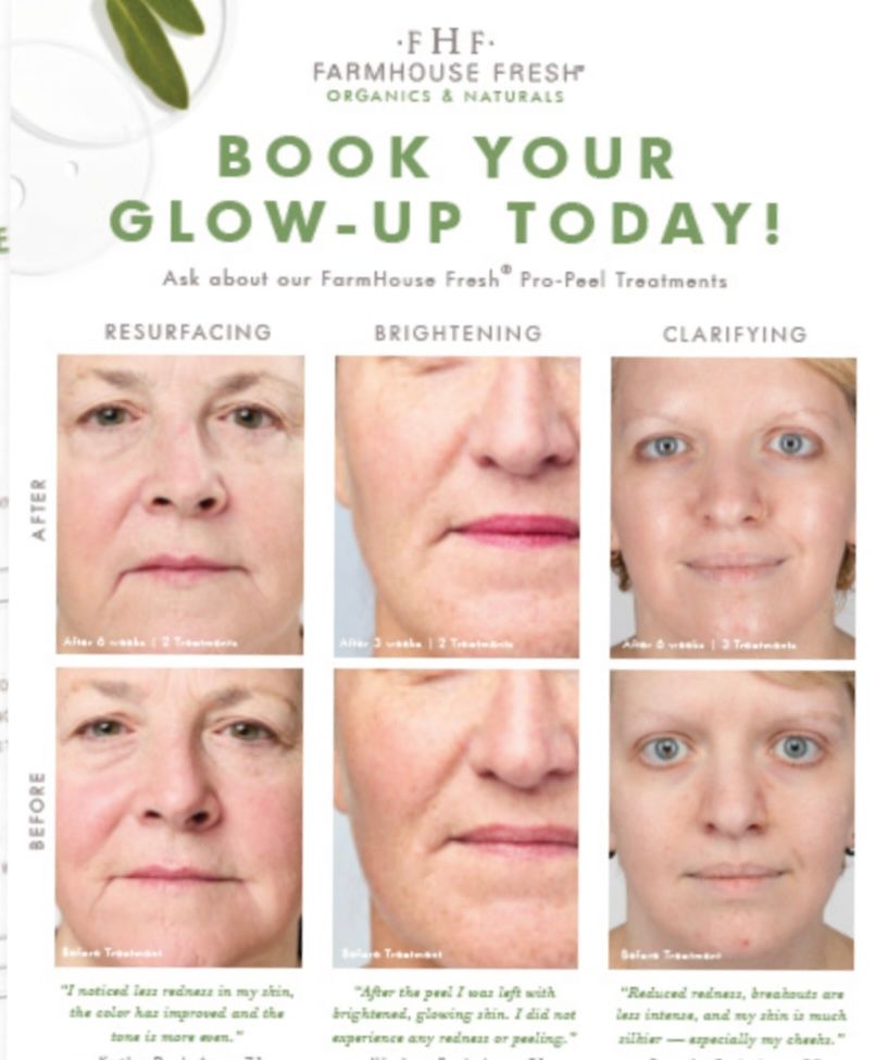 FarmHouse Fresh promotional flyer showing before and after photos of three different facial skin treatment results.