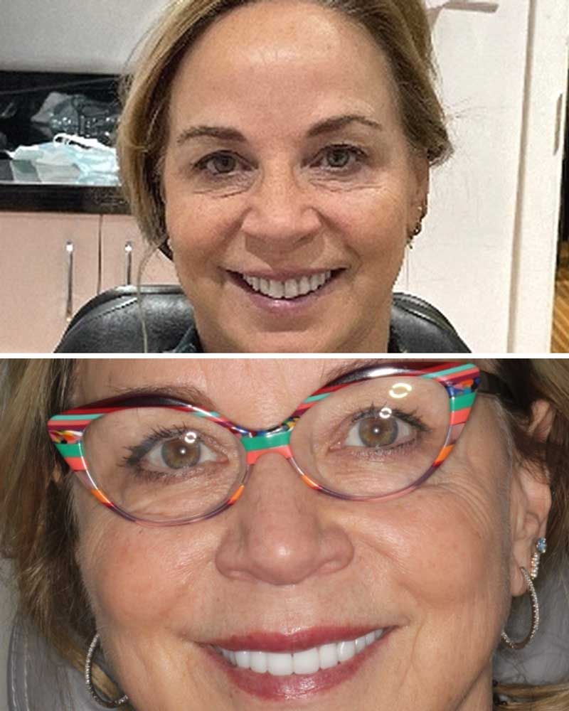Before & After - Alice Mahoney
