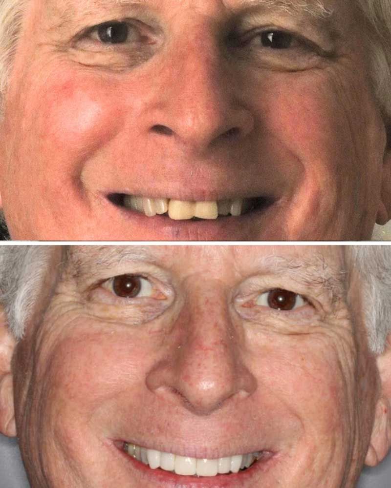 Before & After - Mark Scott Paine