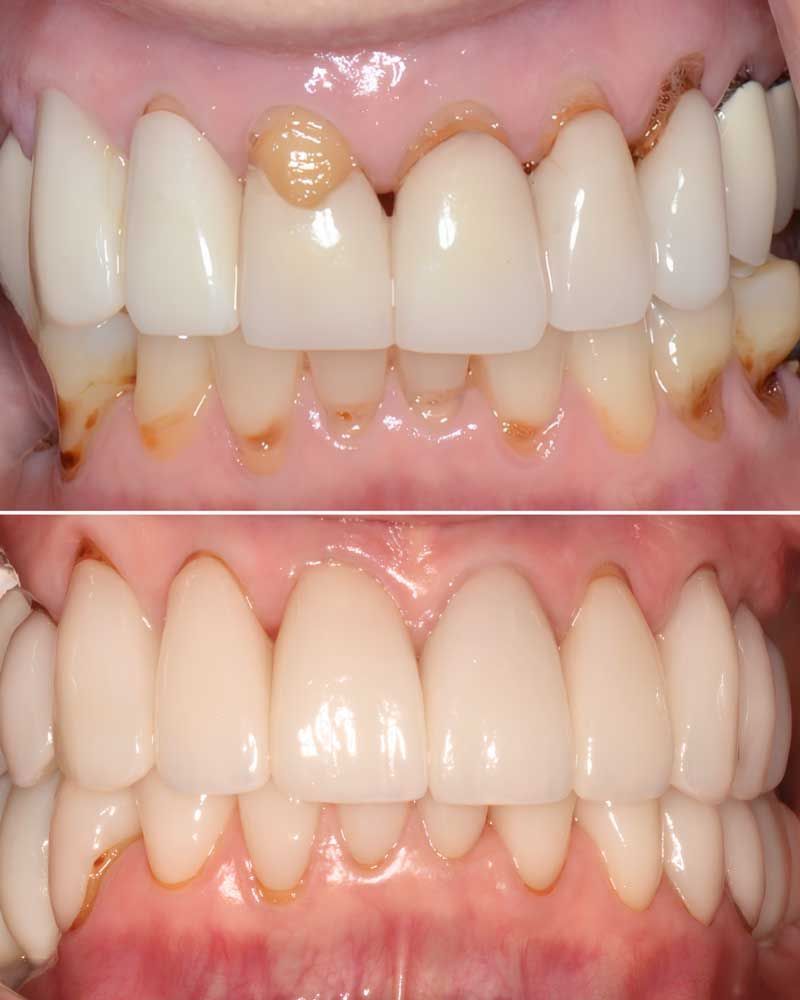 Before & After - Jody Olivia