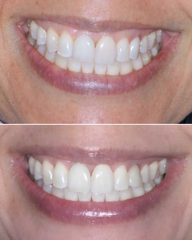 Before & After - Jordana Lynch