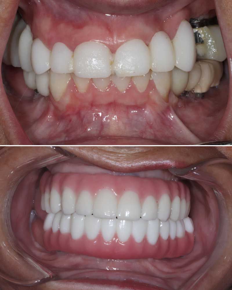 Before & After - Wendy Heiman