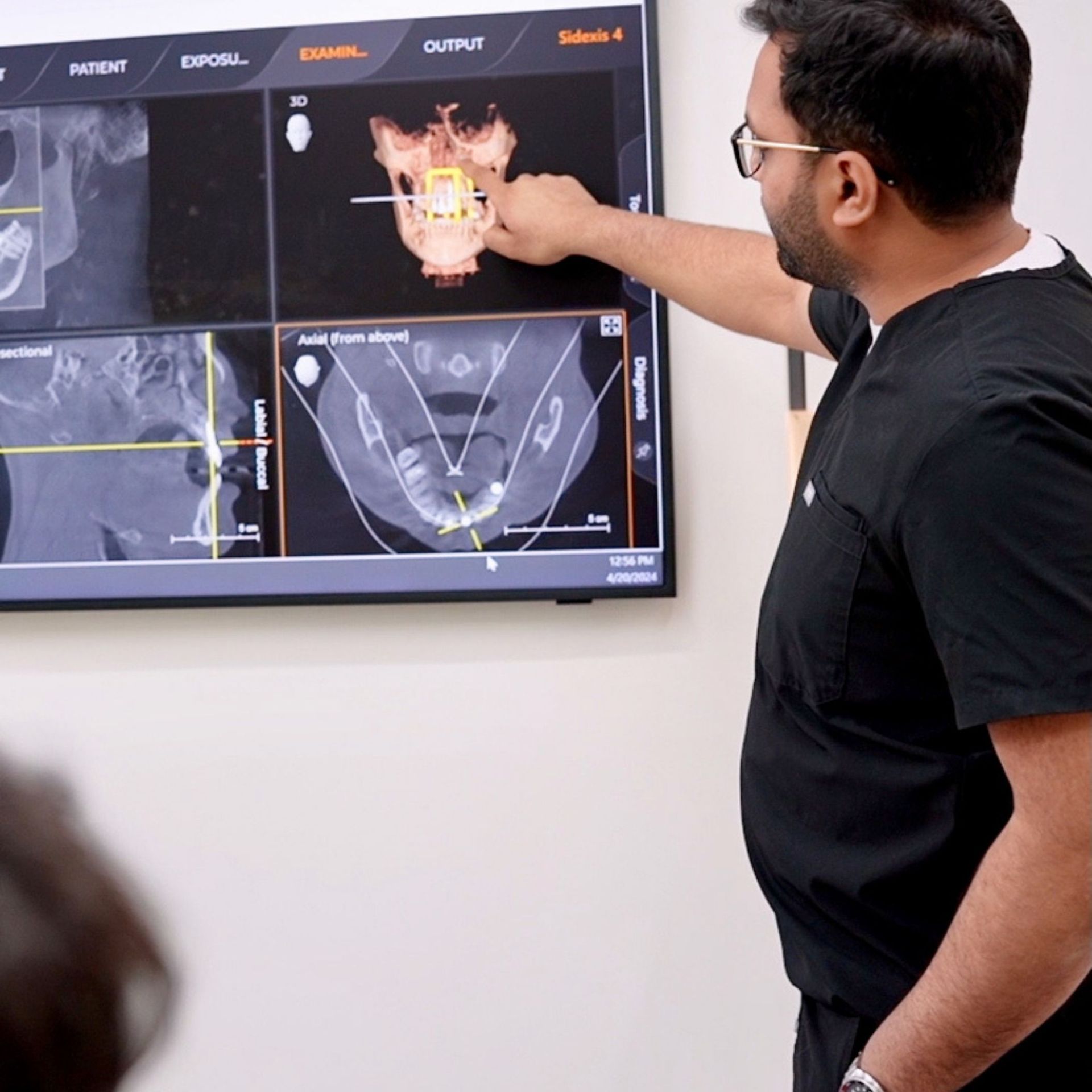 A doctor points to a CT scan of a jaw on a screen. He wears glasses and a black scrub top.