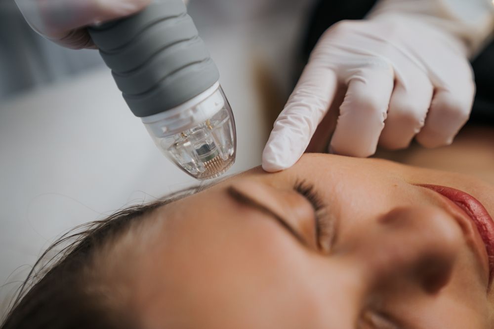 Gloved hands using a handheld skin treatment device on a woman’s face in a spa clinic