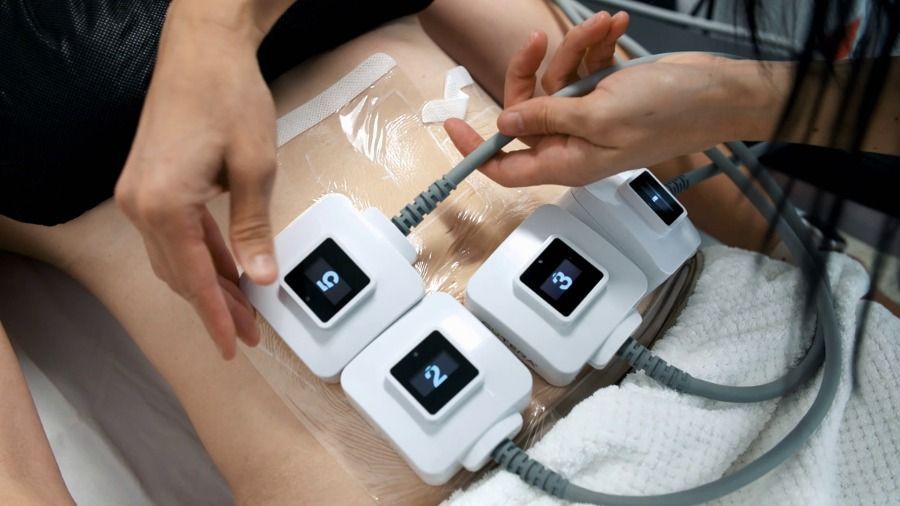 trusculpt fat reduction huntington beach