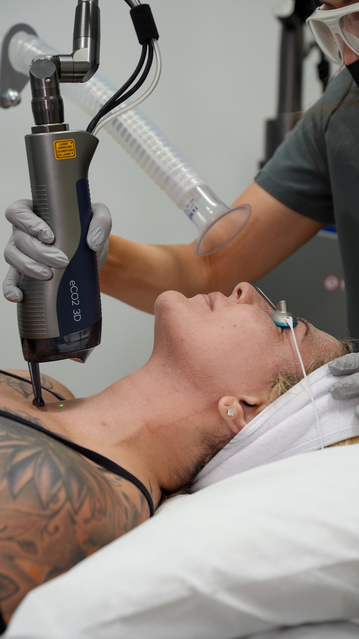 A woman is getting a laser treatment on her face.