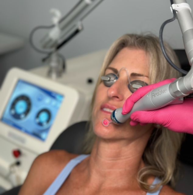 laser face treatment huntington beach