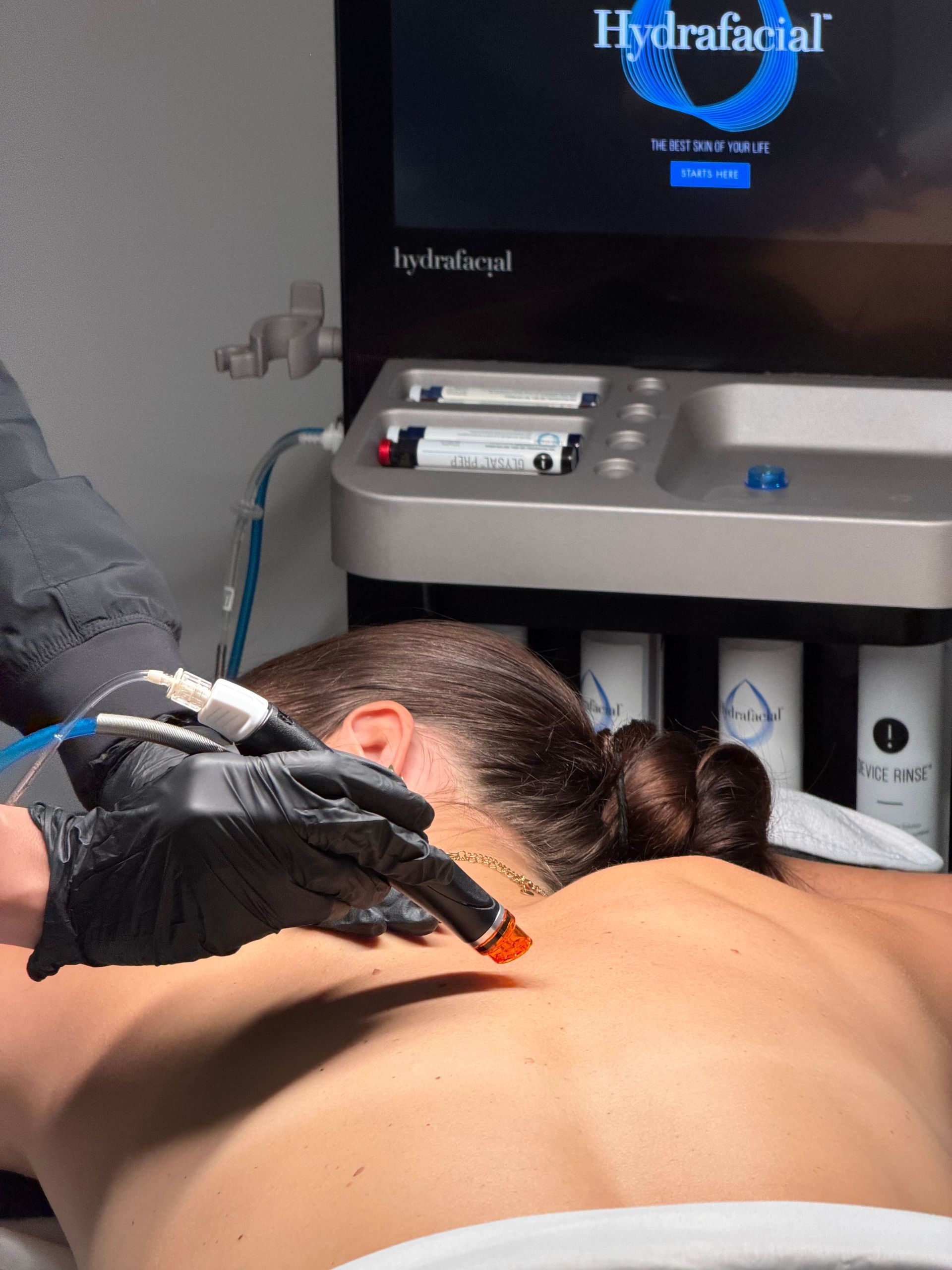 hydrabody treatment