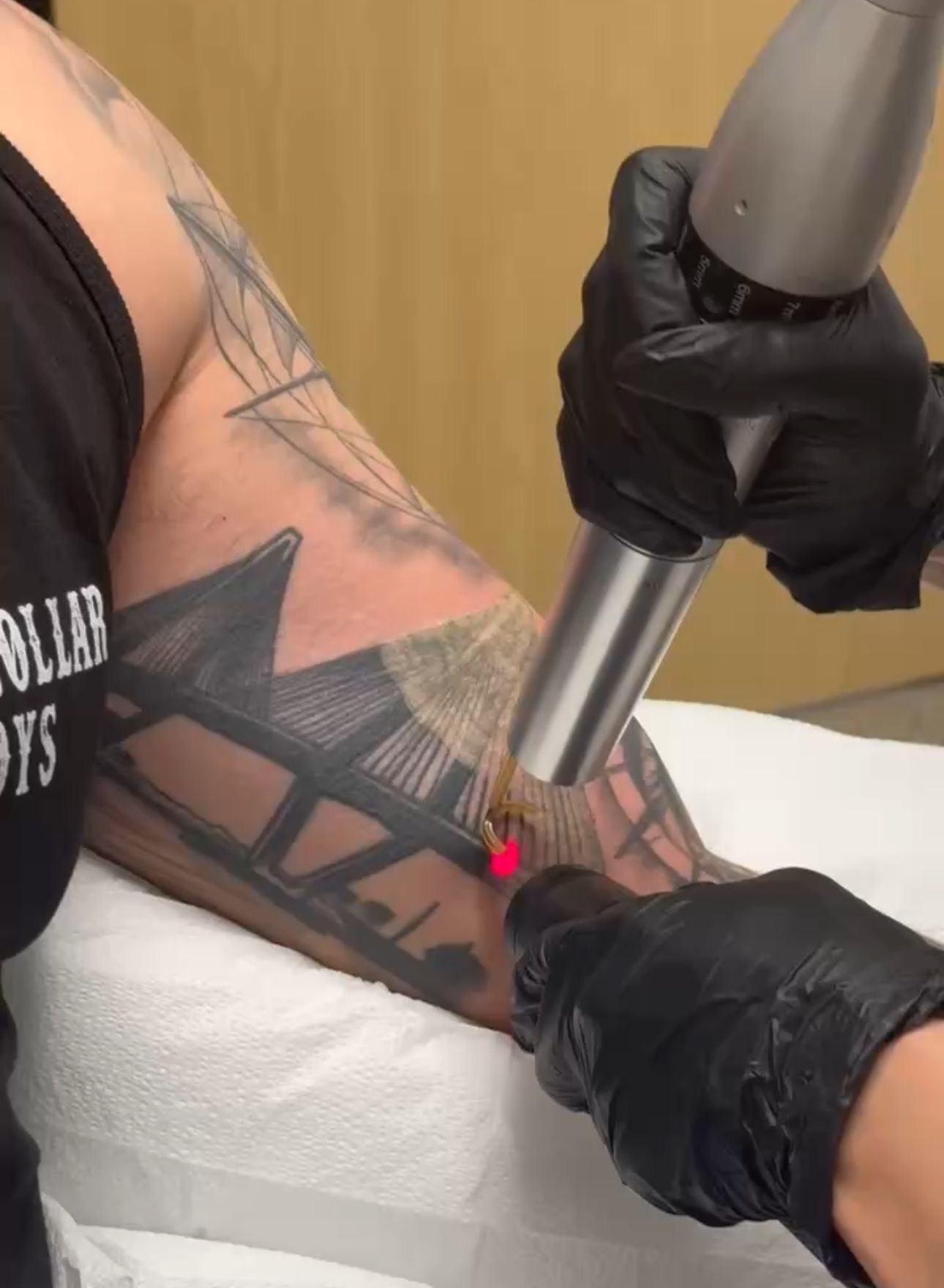 tattoo removal huntington beach