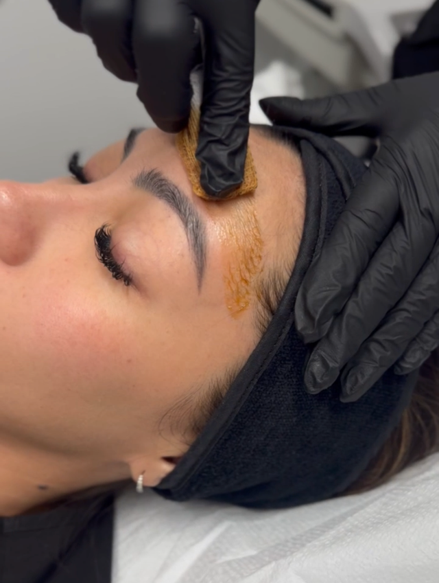 Facial Rejuvenation | Huntington Beach