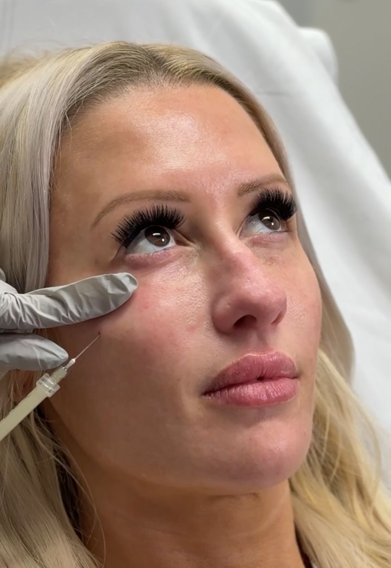 A woman is getting a botox injection in her forehead.
