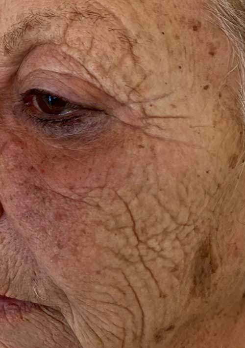 hard peeling for anti-aging before of an old lady