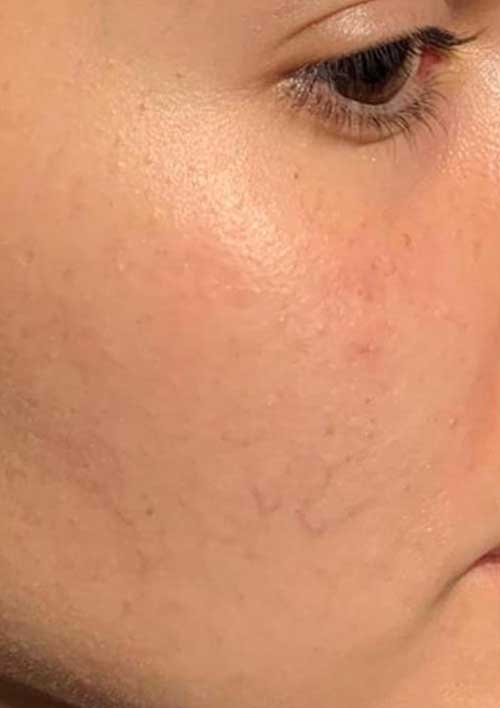 skin texture