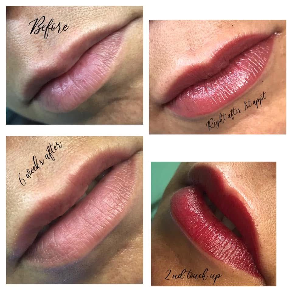 Lip blushing procedure before, immediately after, 6 weeks after, and 2nd touch up. Reddish lip color.