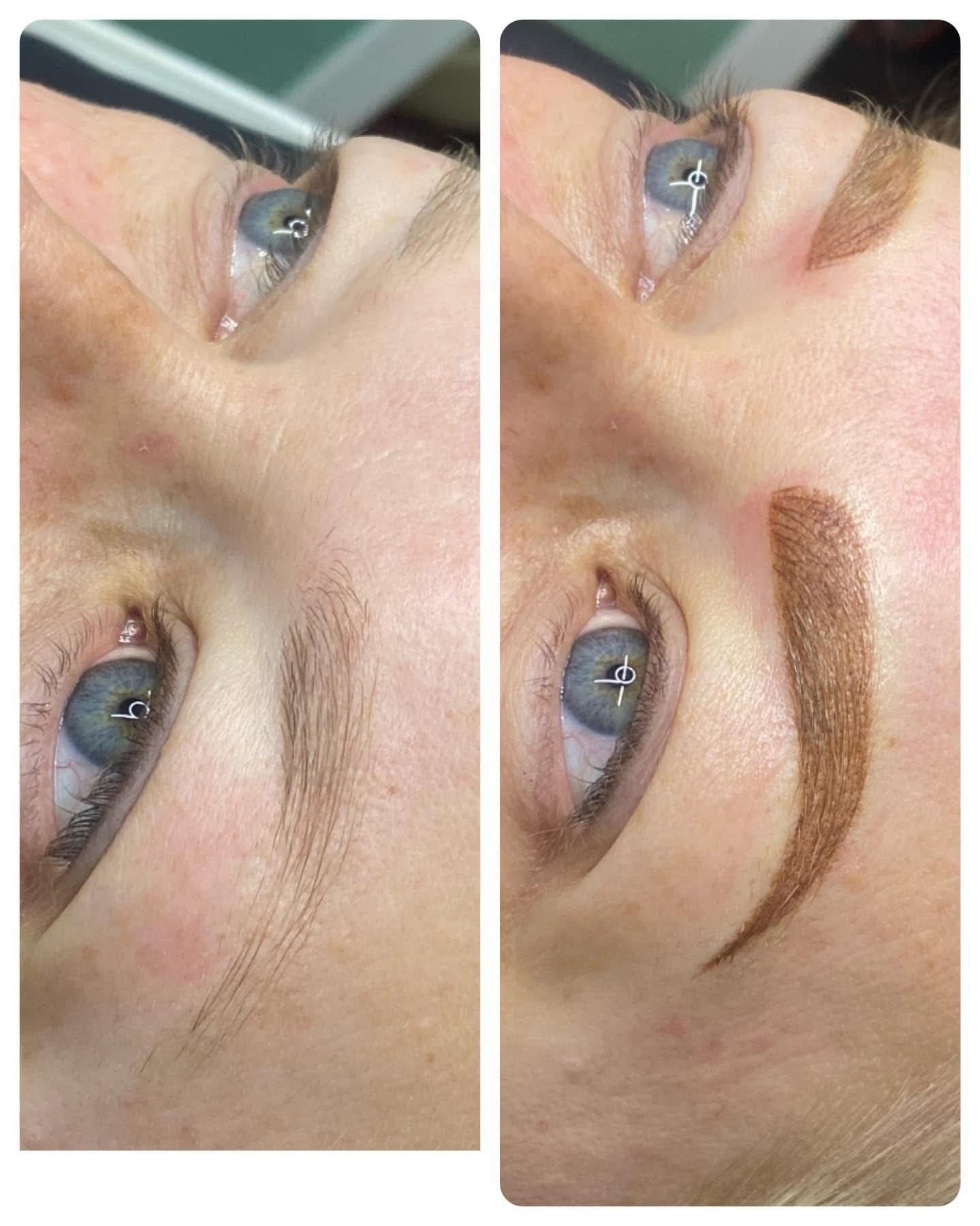 Comparison of eyebrows before and after a cosmetic procedure; light skin, blue eyes.