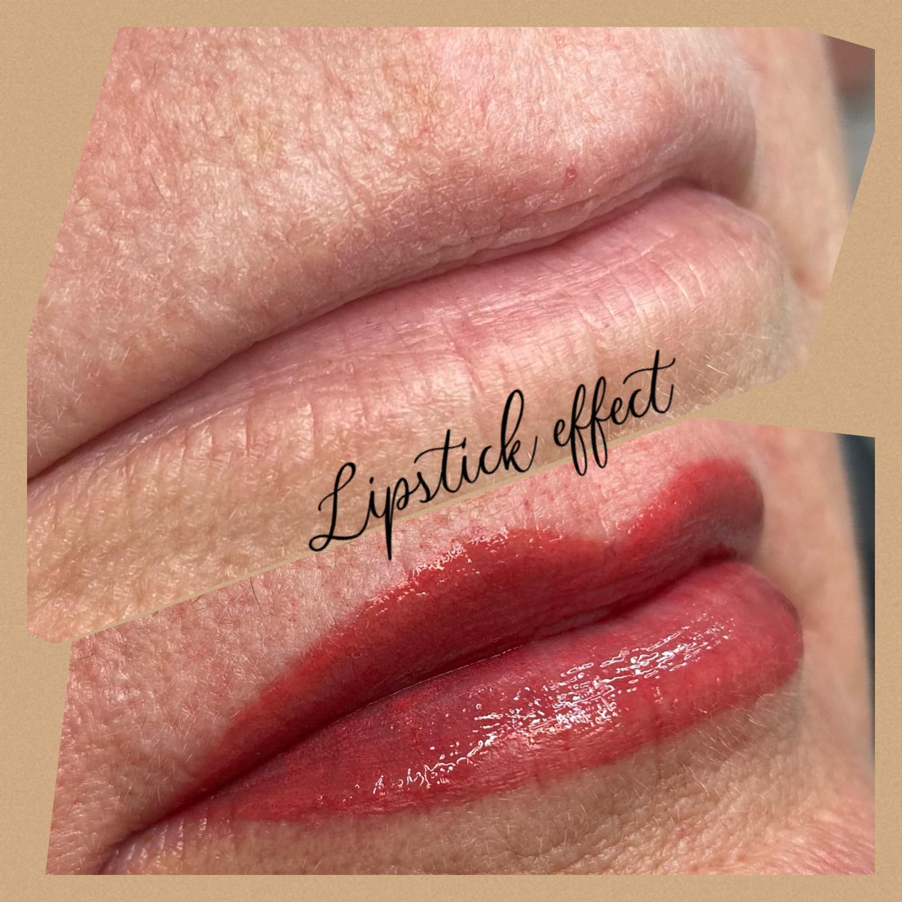 Before and after view of lips with 