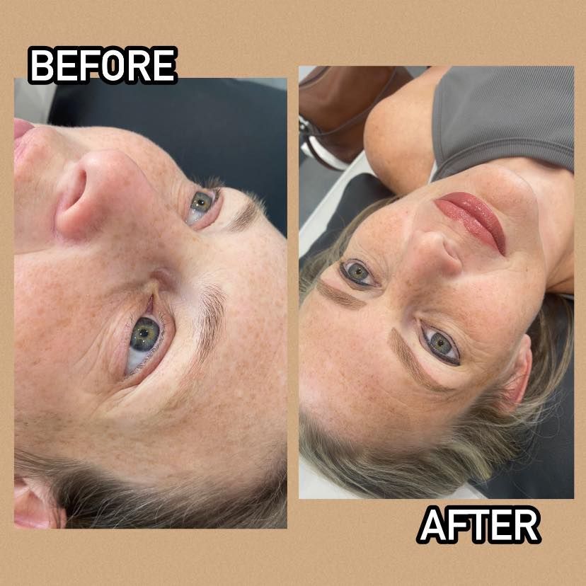 Before/after showing woman's face. 