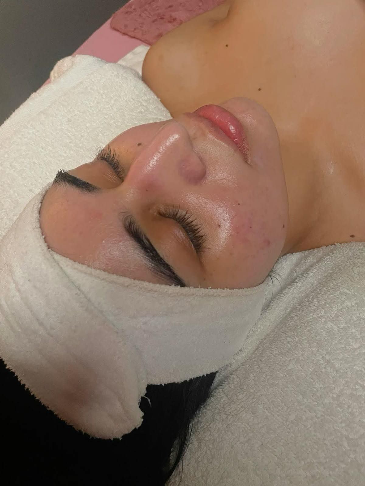 Woman with face bandaged for facial treatment, lying down. Eyes closed, skin looks refreshed.