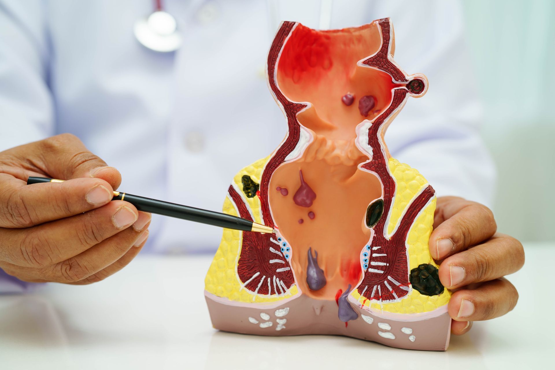 Man holding his backside. Hands pointing to a kidney cross-section model with a medical tool in a clinic setting