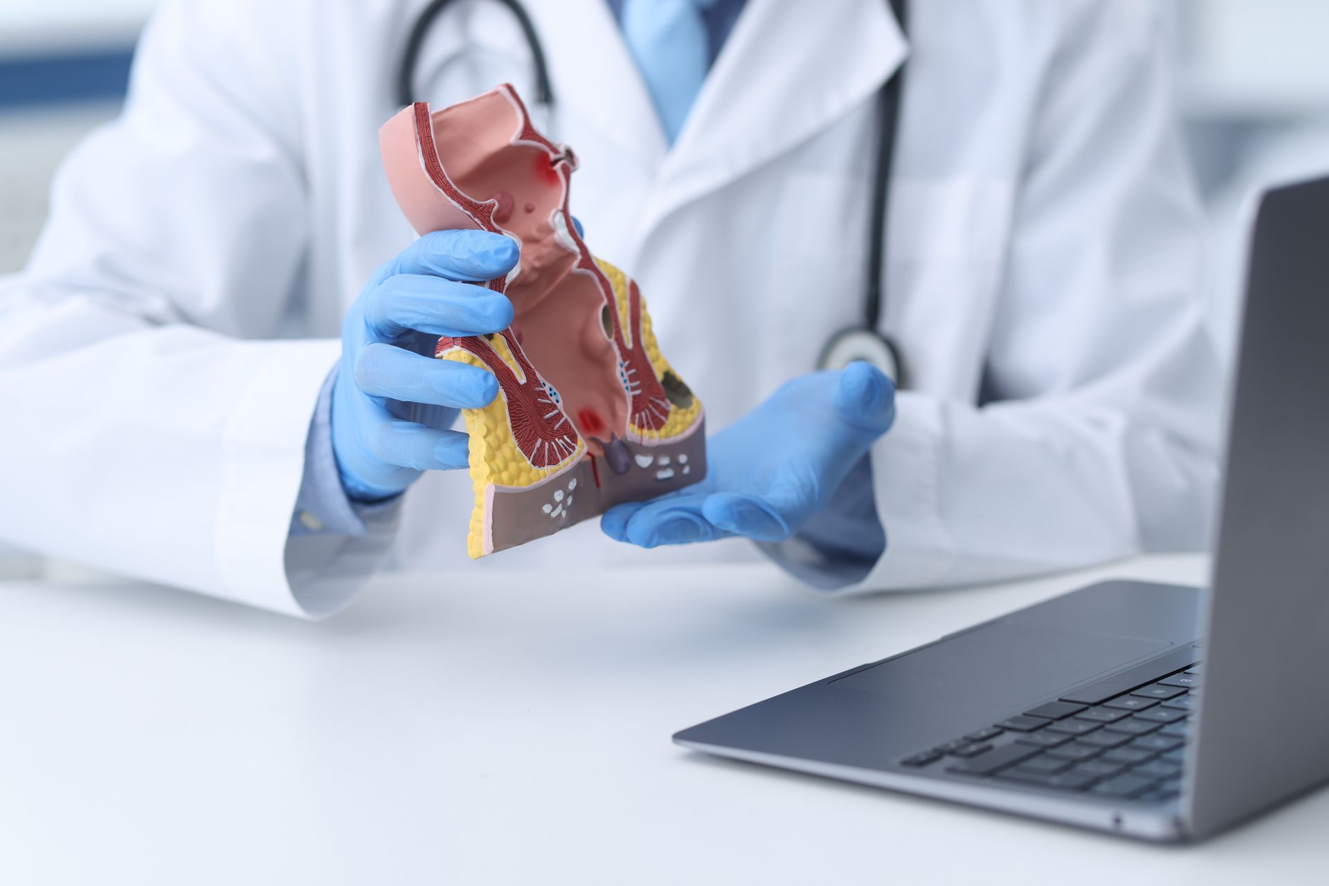Man holding his backside. Gloved clinician holding a 3D anatomical model beside a laptop in a medical office