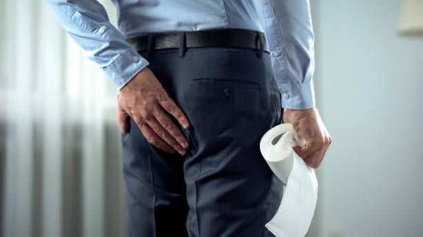 Hemorrhoid Non Surgical Treatment