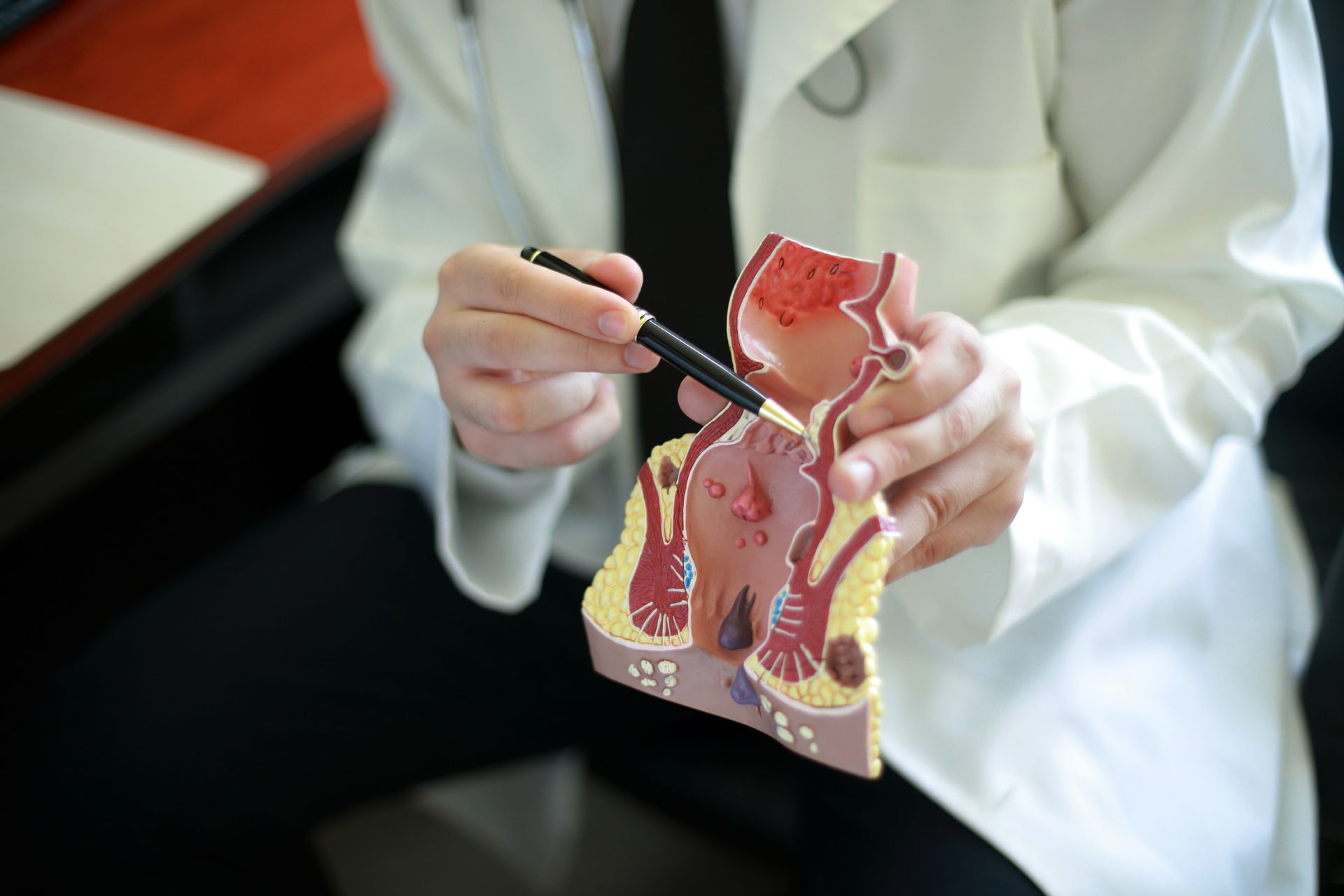 Doctor showing prostate model.