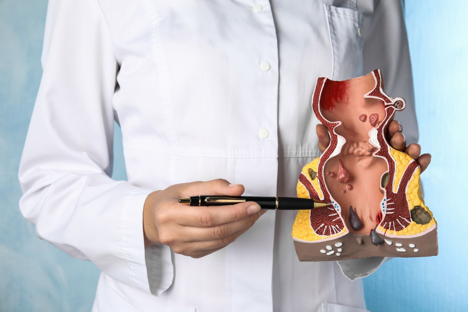 Rectal Condition Care Program