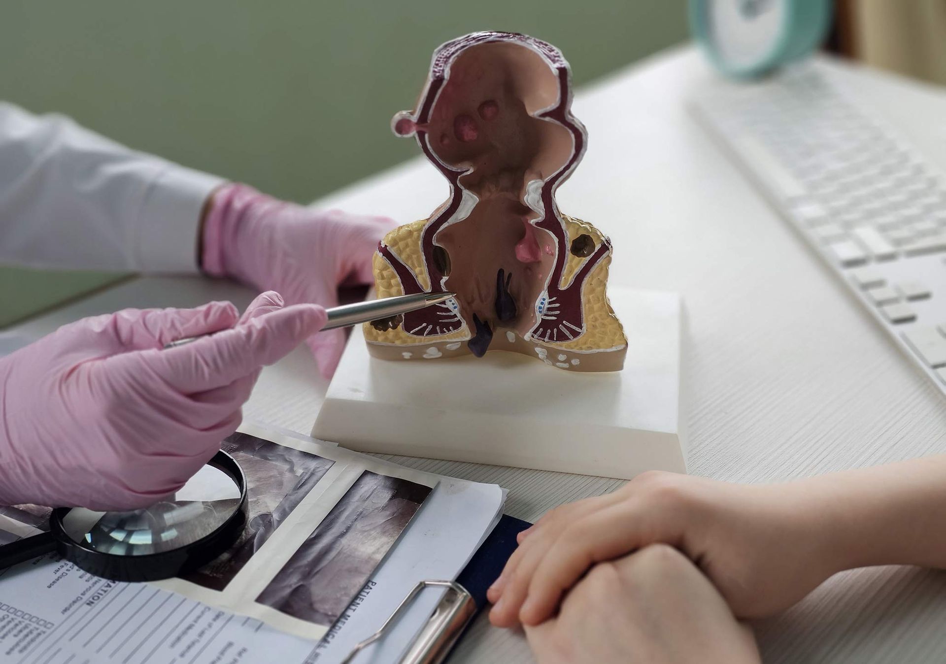 Hemorrhoid exam model