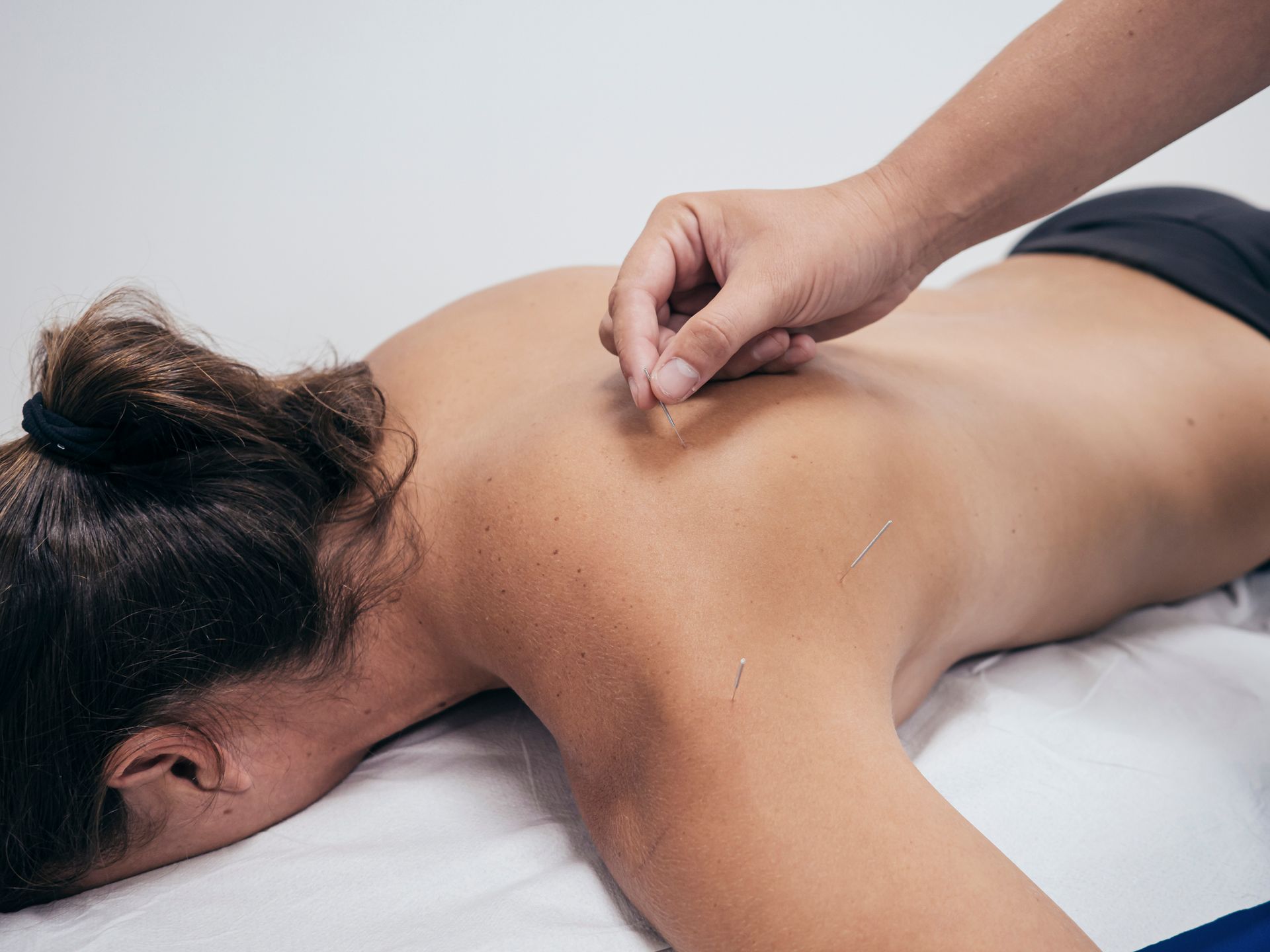 Dry Needling  — Oklahoma City, OK — Specialized Physical Therapy