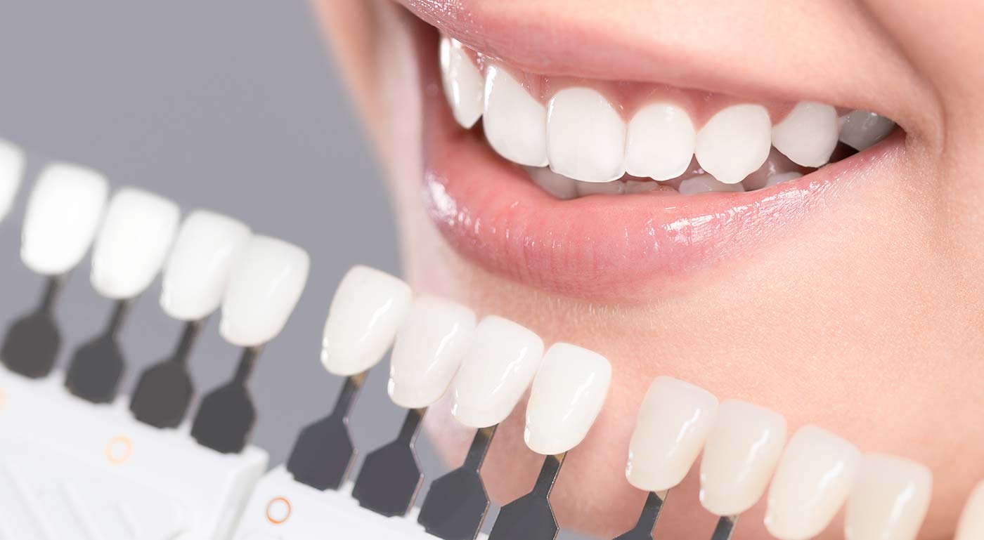 ORAL CLINICA DENTAL - BLANQUEAMIENTO DENTAL