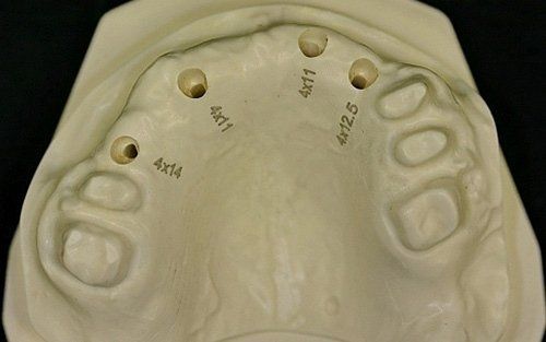 Calco dentale del palato superiore con quattro piccoli fori e impronte dentali