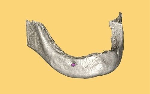 Mandibola grigia renderizzata in 3D su sfondo giallo