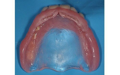 Impronta dentale rosa su sfondo blu
