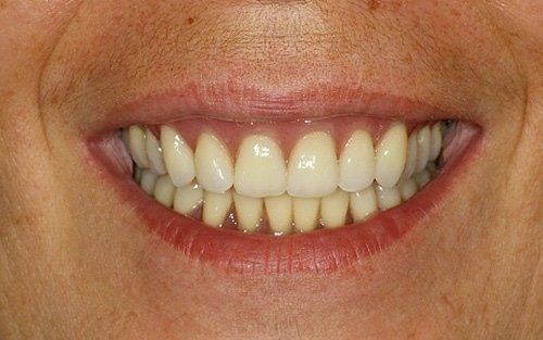 Primo piano di una bocca sorridente che mostra denti e labbra