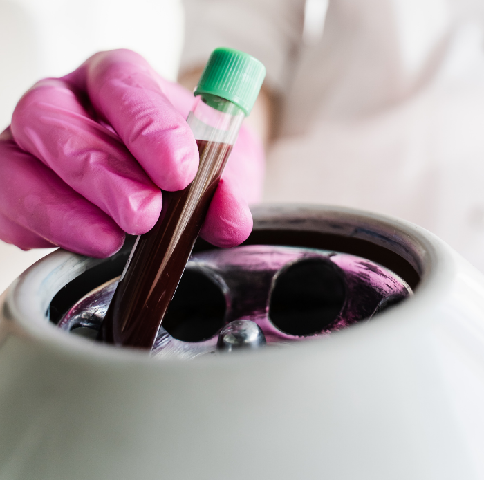 Gloved hand holding blood sample tube in a laboratory centrifuge tray