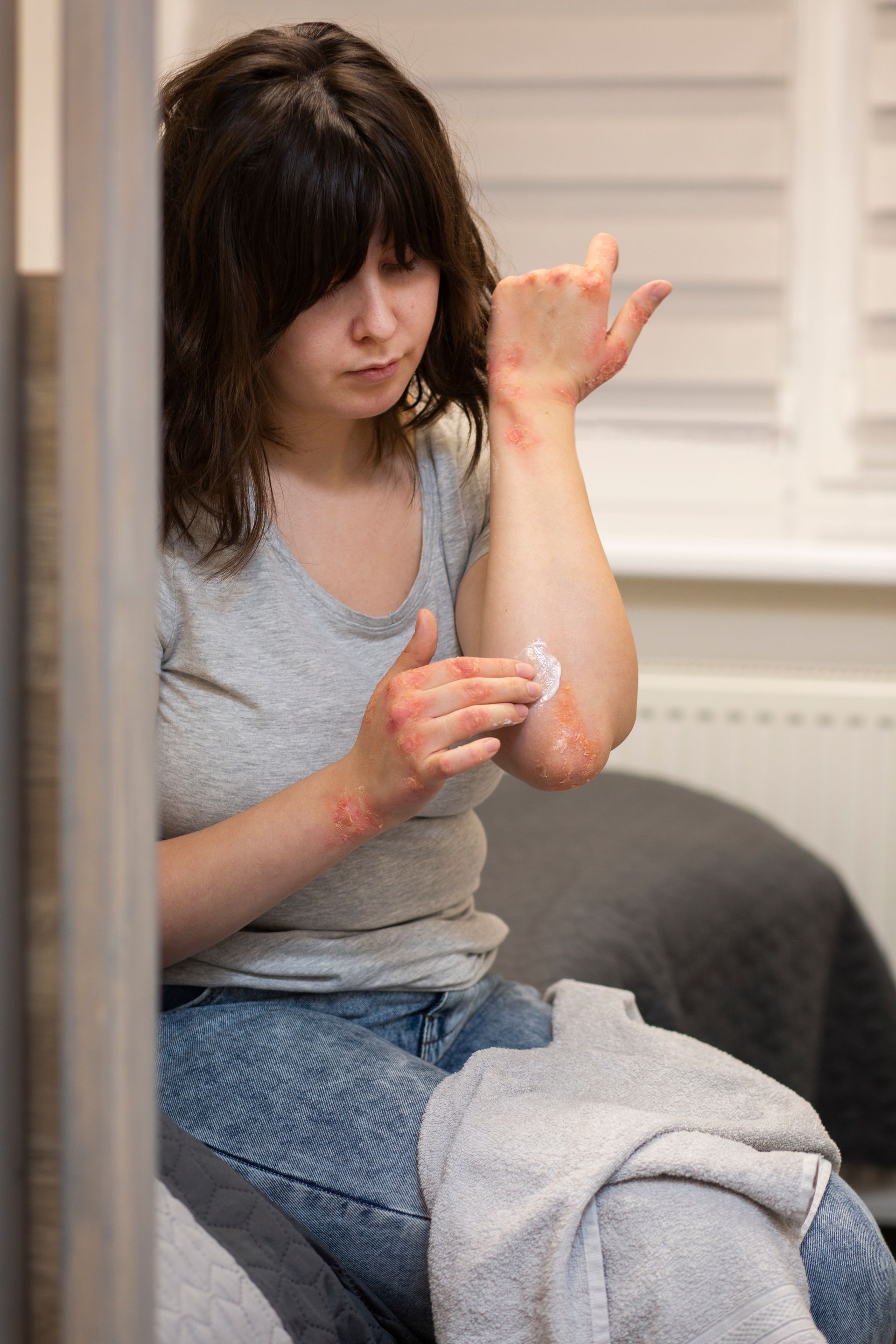 Woman sitting on a couch, applying lotion to her arm beside a folded towel