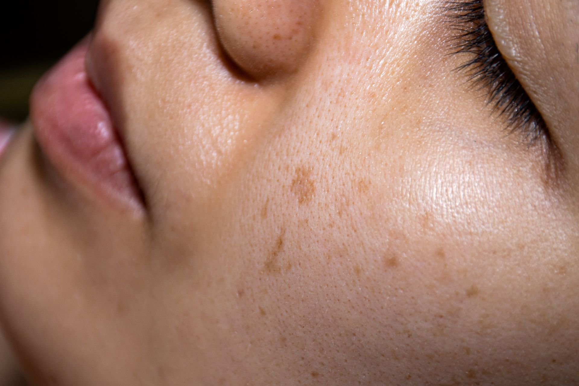 Close-up of a cheek with freckles and a nose, eyes closed in soft light