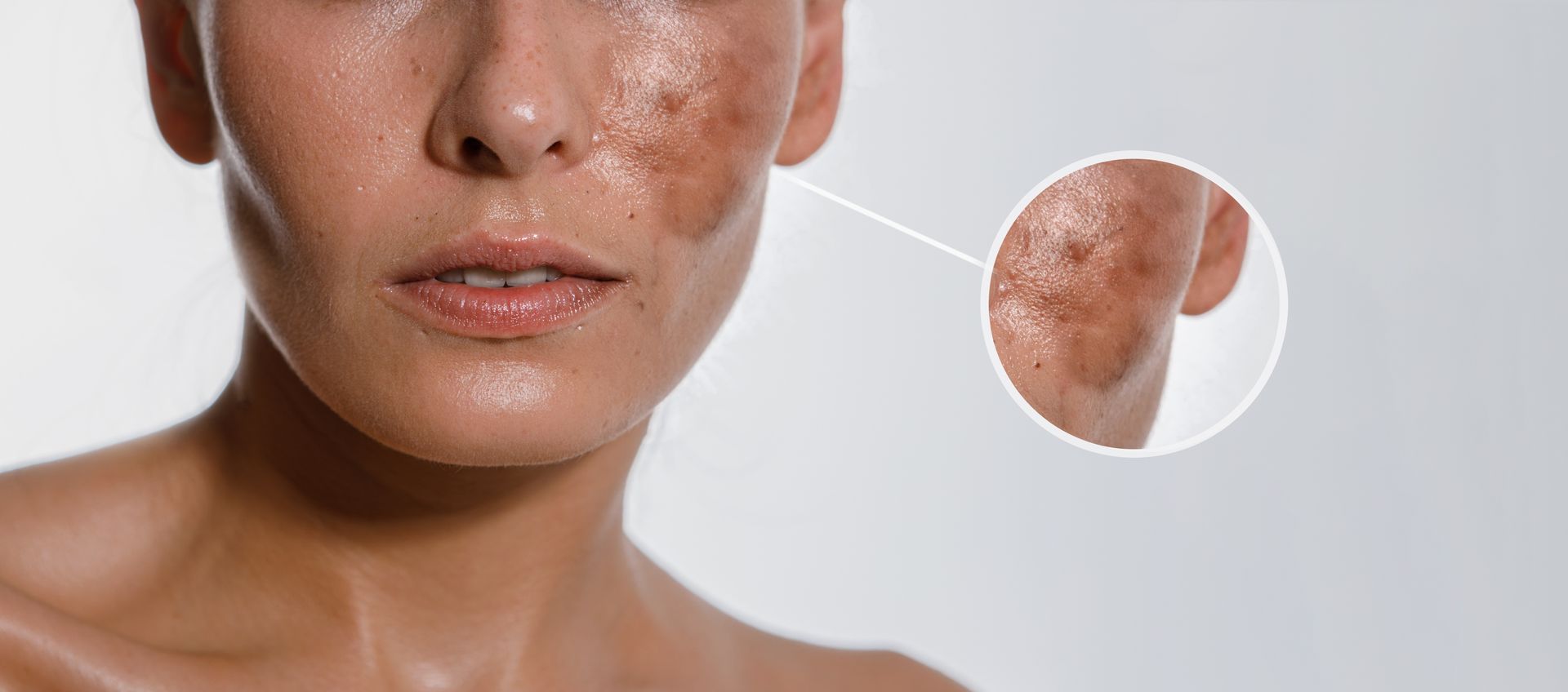 Close-up of a freckled face with a circular inset highlighting skin on the neck and jawline