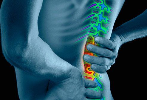 Sciatica Pain Treatment Dr. Brett Thomas