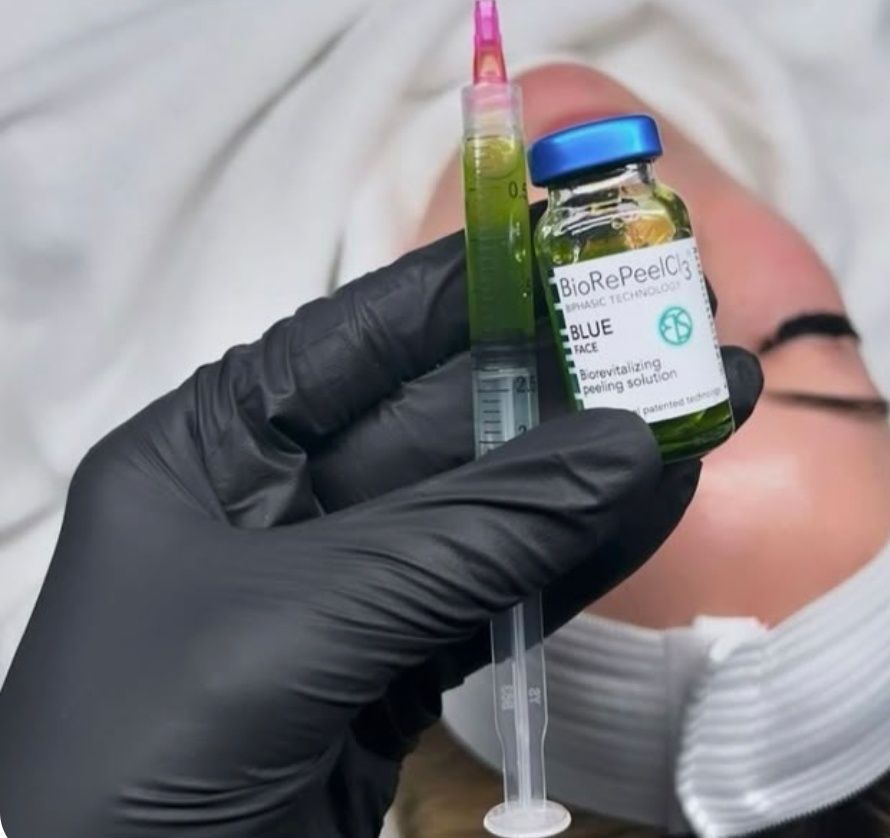 Een gehandschoende hand houdt een spuit en een flesje met BioRePeel TCA peeling boven het gezicht van een persoon.