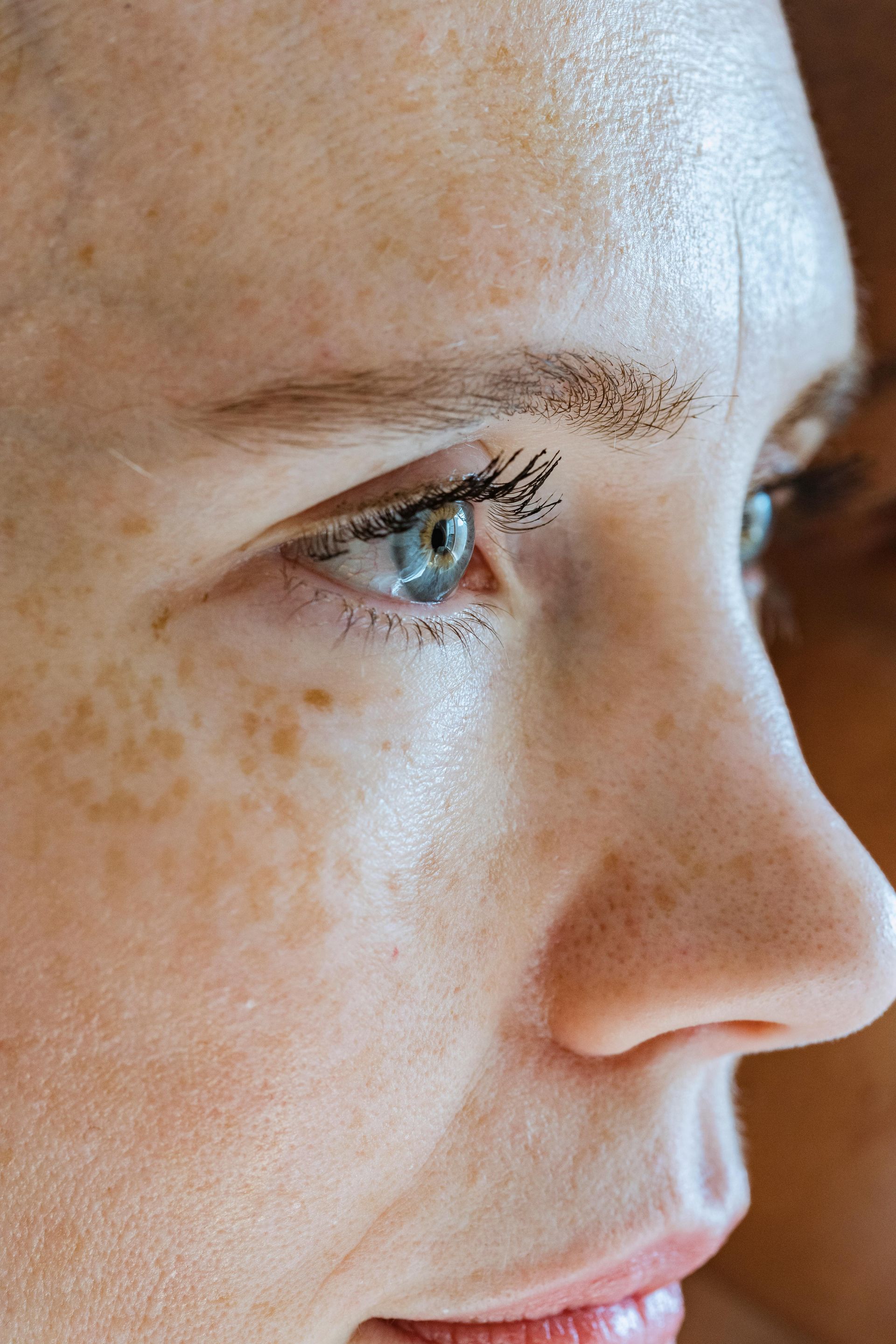 Close-up zijprofiel van een gezicht met sproeten en een blauw oog, dat naar rechts kijkt.