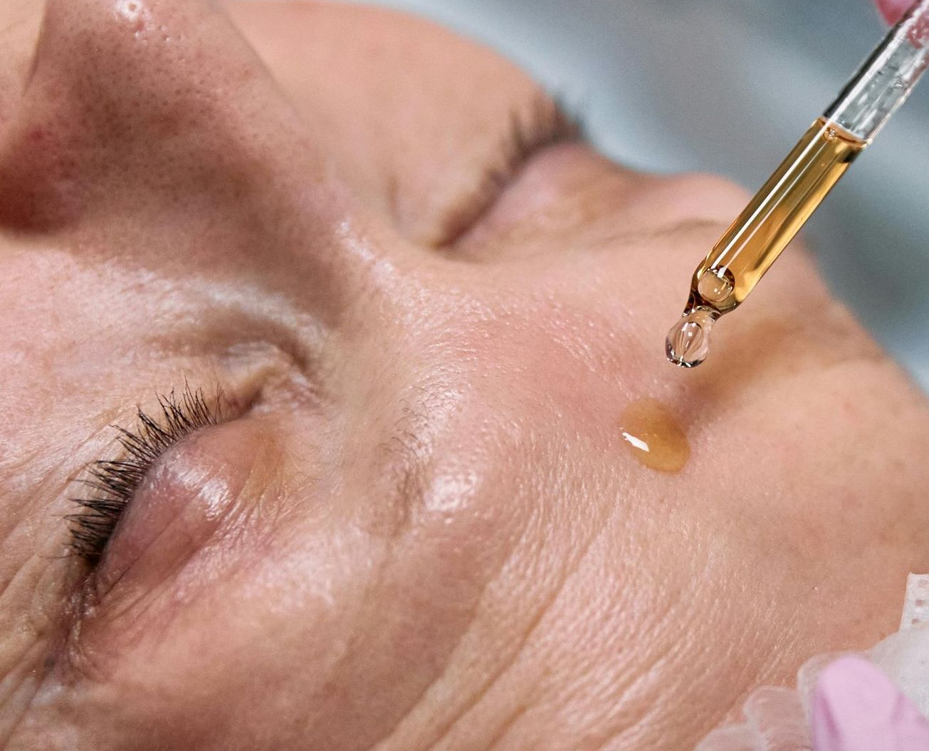 Een oudere vrouw met rimpels krijg een anti-aging gezichtsbehandeling met peeling.