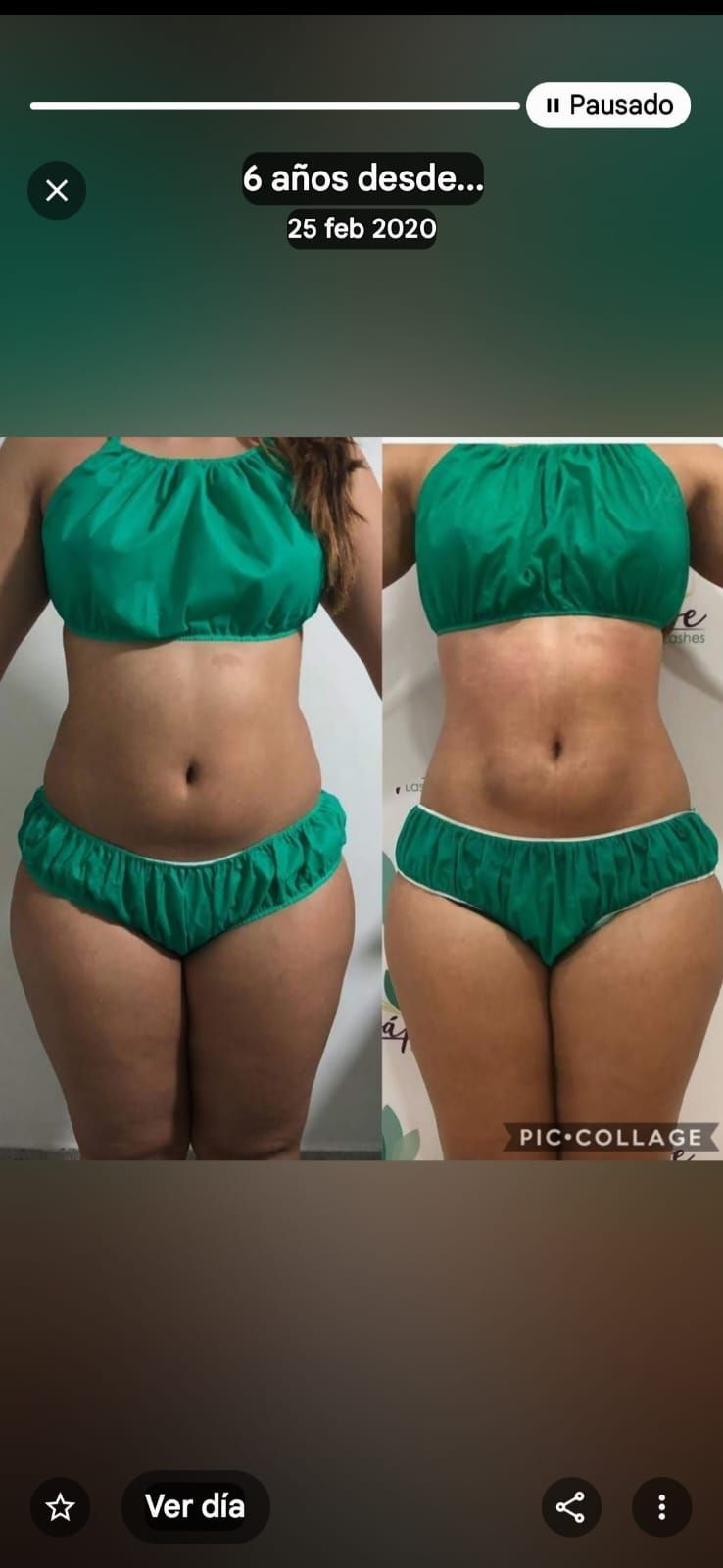 Transformación corporal antes y después, lado a lado, en bikini verde sobre un fondo liso.