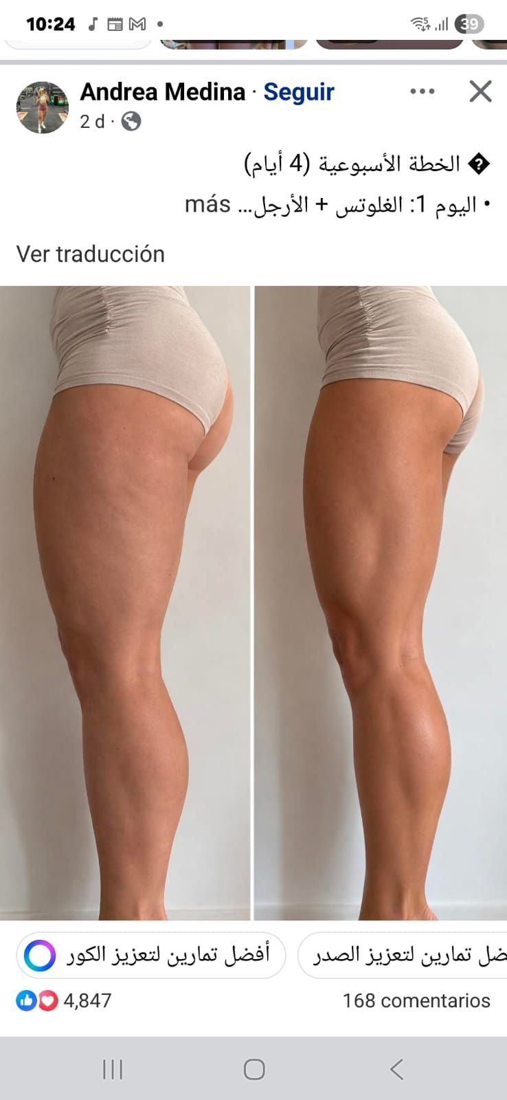 Fotografías de perfil, una al lado de la otra, de las piernas y las caderas de una persona en ropa interior clara, que muestran una comparación del antes y el después.