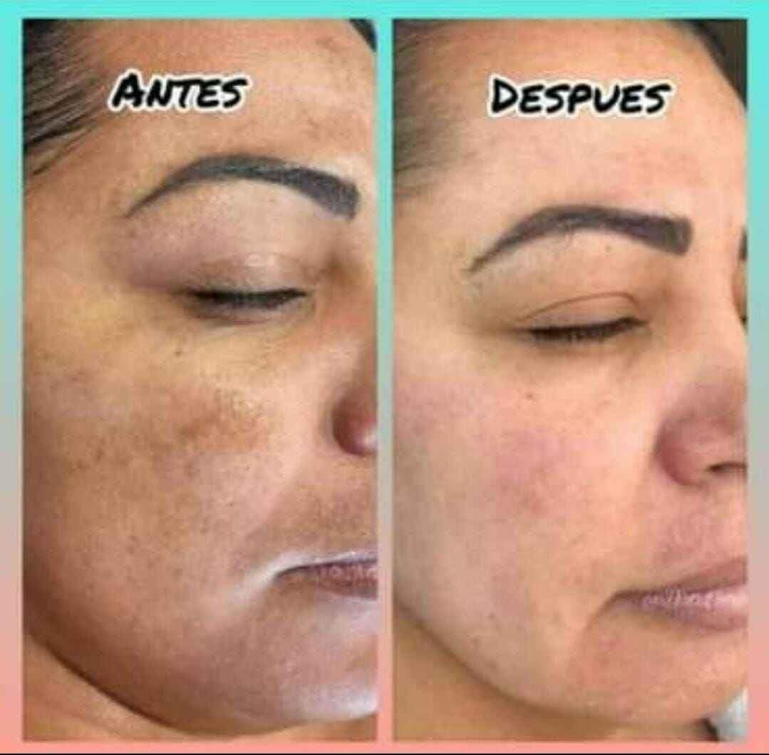 Primer plano de un rostro, dividido en dos partes, que muestra el maquillaje aplicado, etiquetado como “ANTES” y “DESPUÉS”.