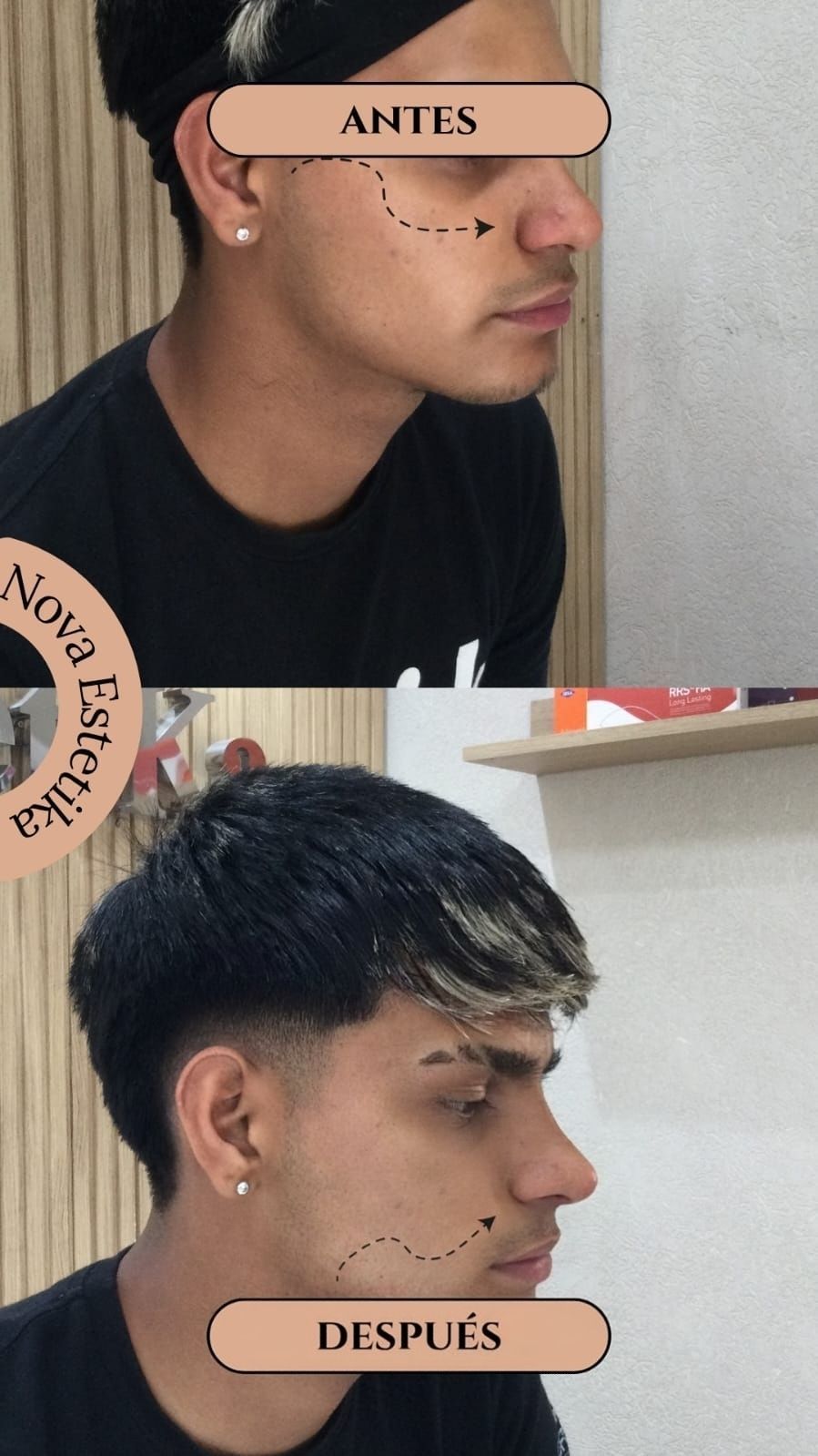 Perfil lateral de un hombre antes y después de un corte de pelo más corto y texturizado, etiquetado como “ANTES” y “DESPUÉS”.