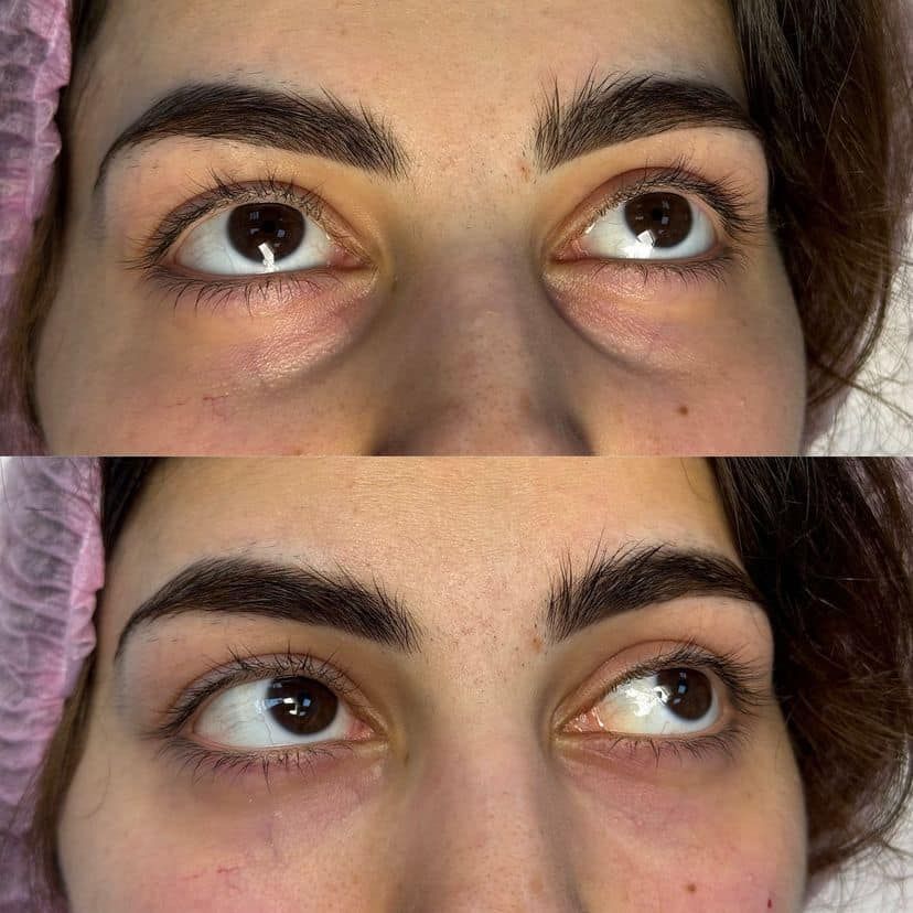 Primer plano de los ojos de una persona mirando hacia arriba, mostrado en dos tiras fotográficas horizontales.